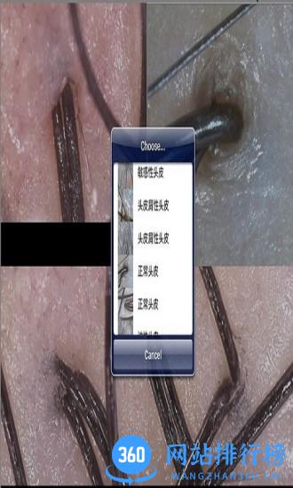 MRKV头皮检测仪 V20231017_36安卓版 3