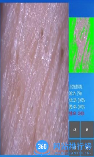 MRKV头皮检测仪 V20231017_36安卓版 2