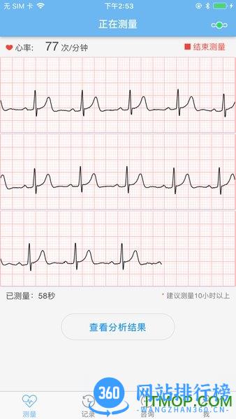 数维康心电 v1.9.86.0安卓版 1