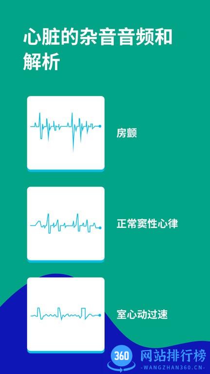 心电图ECG