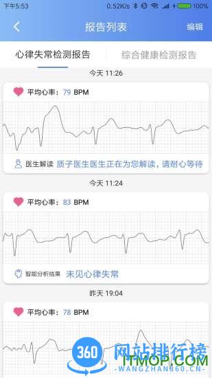 卡帕奇心电app下载