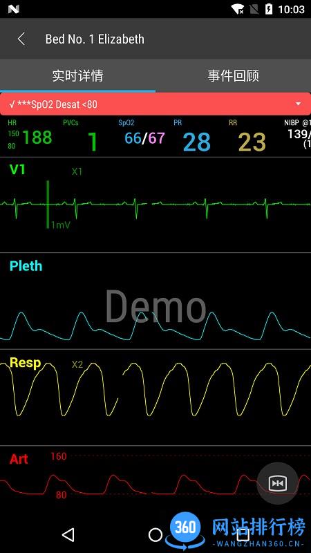 Mobile Viewer(胎心监护仪) v01.10.00.01 安卓版 2