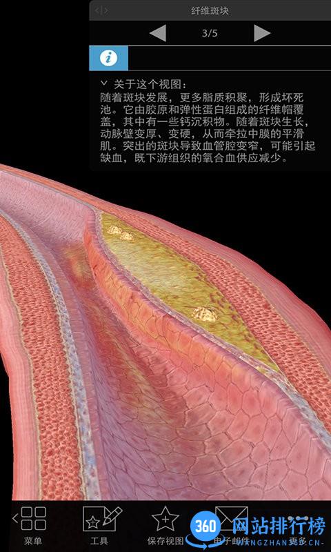 3D生理和病理学医学通 v2 安卓版 1