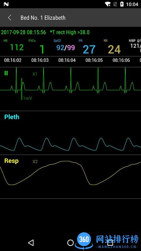 Mobile Viewer(胎心监护仪) v01.10.00.01 安卓版 1