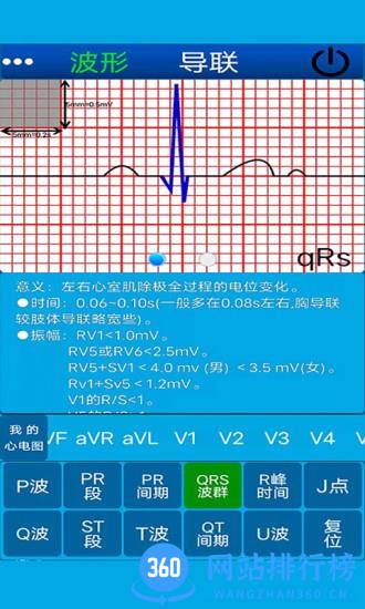 心电图计算器 v1.4.5 安卓版 3
